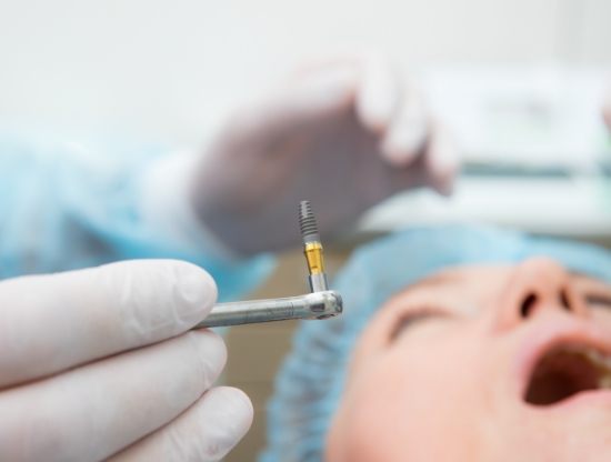 Dentist holding a dental implant right before placing it in a patient