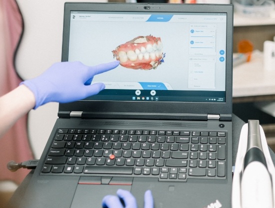 Dentist pointing to computer screen showing digital impressions of teeth