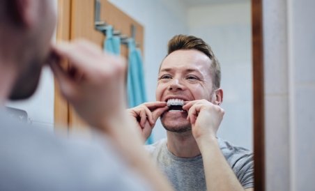Man placing take home whitening tray over his teeth