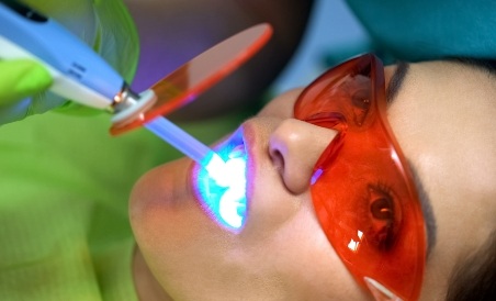 Dental patient having their teeth professionally whitened